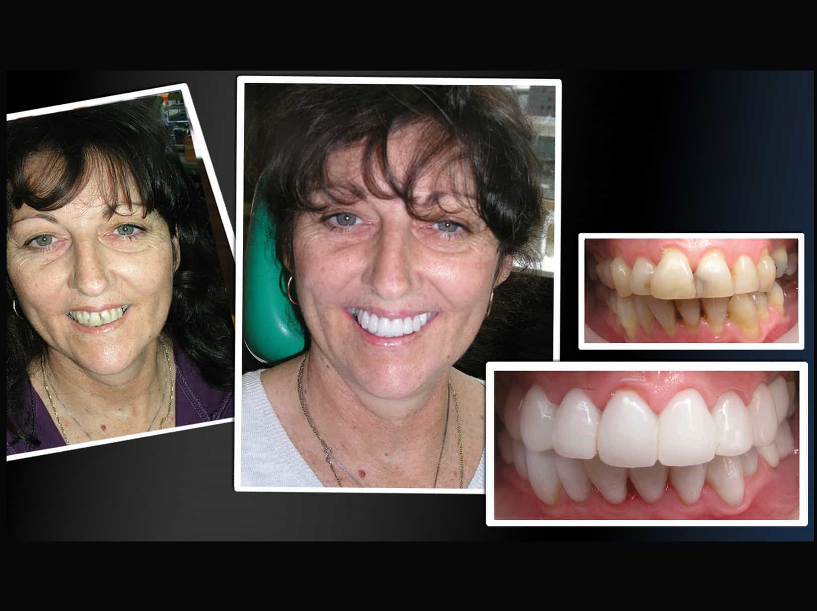Best Cosmetic Dentist Melbourne #1 Cosmetic Dentist in Melbourne Australia Dr Zenaidy Castro