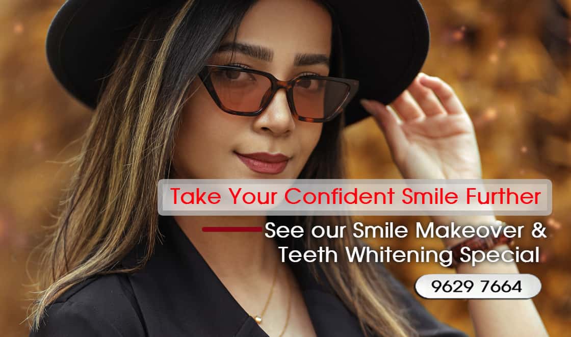 Veneers and Smile Makeovers in Melbourne CBD and Noble Park north | Lowest, CHEAPEST Price in Melbourne