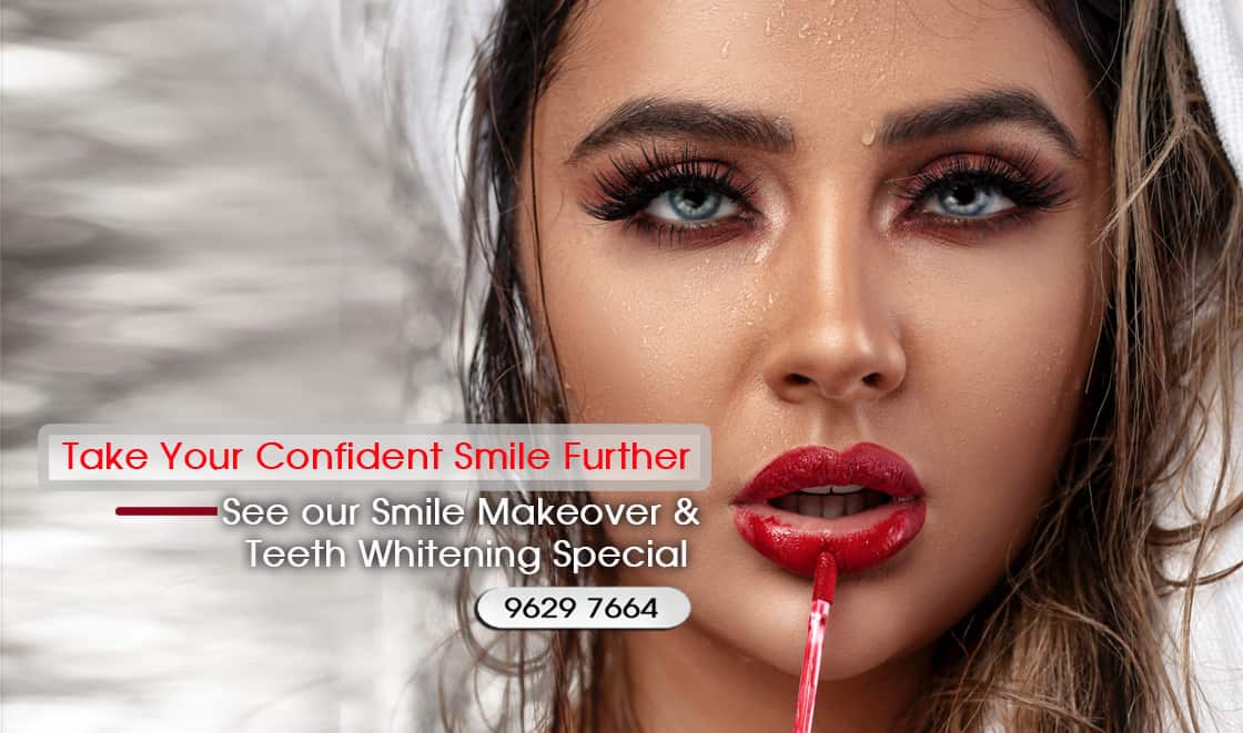 Full Mouth Porcelain Veneers Prices Packages Melbourne
