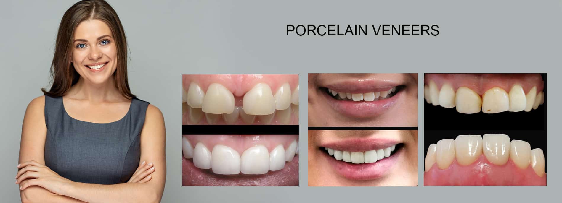Cosmetic Dentistry Melbourne, Best Cosmetic Dentist in Melbourne CBD, Smile Makeover Melbourne