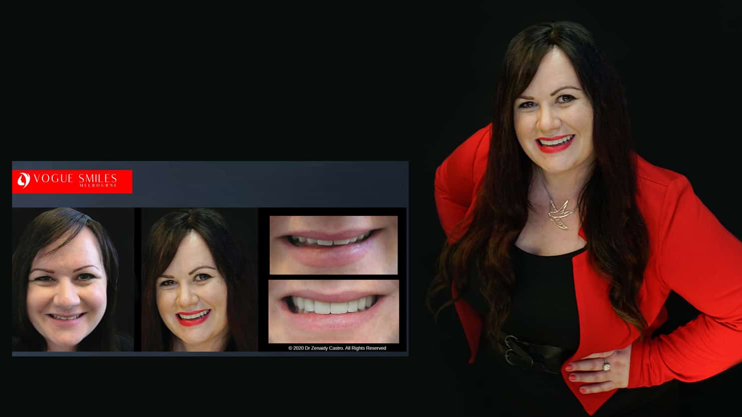 Affordable Cosmetic Smile Makeover Solutions in Melbourne