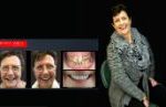 Cosmetic Dentistry Smile Makeovers Before and After Smile Gallery | Australia's Top Cosmetic Dentist