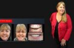 Cosmetic Dentistry Smile Makeovers Before and After Smile Gallery | Australia's Top Cosmetic Dentist