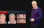 Cosmetic Dentistry Smile Makeovers Before and After Smile Gallery | Australia's Top Cosmetic Dentist