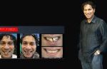 Cosmetic Dentistry Smile Makeovers Before and After Smile Gallery | Australia's Top Cosmetic Dentist