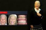 Cosmetic Dentistry Smile Makeovers Before and After Smile Gallery | Australia's Top Cosmetic Dentist