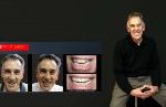 Cosmetic Dentistry Smile Makeovers Before and After Smile Gallery | Australia's Top Cosmetic Dentist