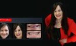 Cosmetic Dentistry Smile Makeovers Before and After Smile Gallery | Australia's Top Cosmetic Dentist