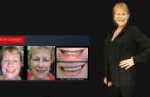 Cosmetic Dentistry Smile Makeovers Before and After Smile Gallery | Australia's Top Cosmetic Dentist