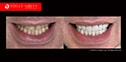Dr Zenaidy Castro Celebrity Smile Makeovers specialist | The best #1 Cosmetic Dentist Melbourne CBD