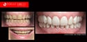 Dr Zenaidy Castro Celebrity Smile Makeovers specialist | The best #1 Cosmetic Dentist Melbourne CBD