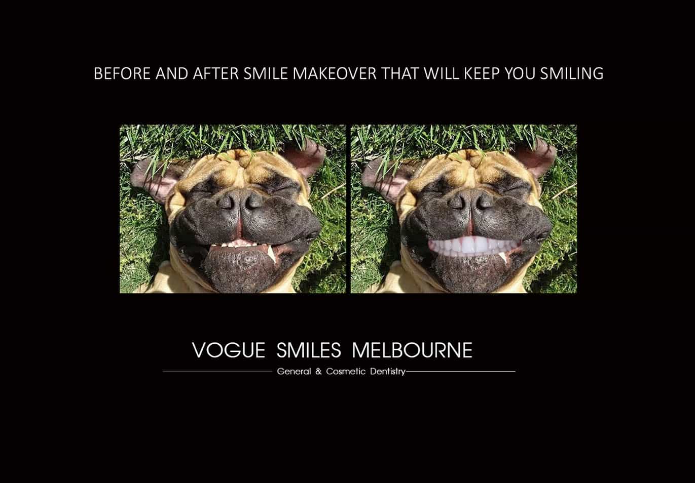 How Much Does Dentist Treatment Cost in Melbourne? How Much Does the Dentist Treatment Cost in Melbourne? How much does the dentist cost Melbourne, Australia