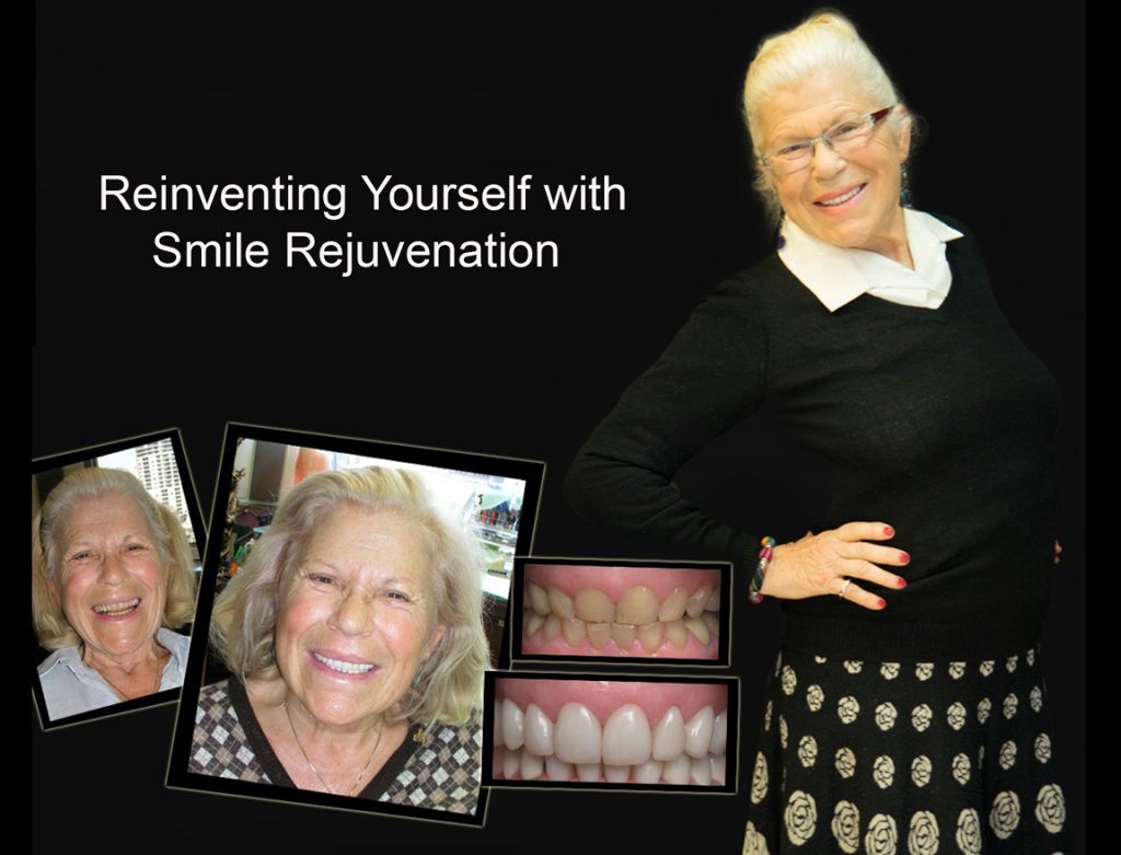Smile Rejuvenation with Cosmetic Smile Makeovers in Melbourne