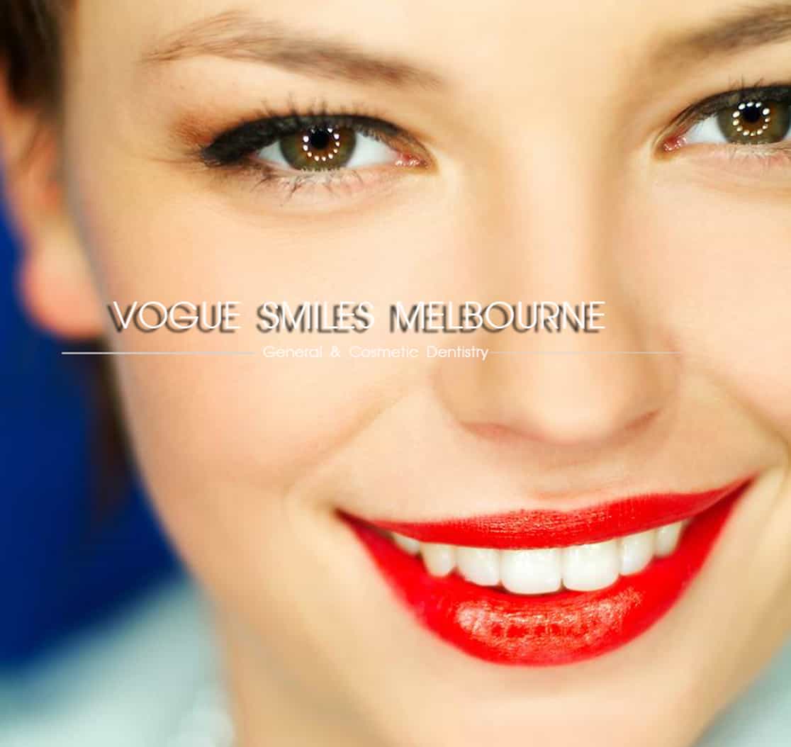 Costs of Cosmetic Dentistry in Melbourne