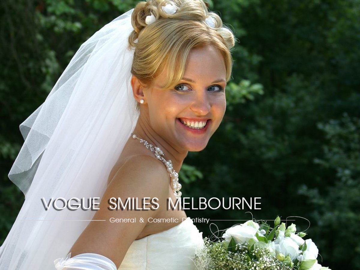 Wedding Smile Makeover for the Budget Savvy Bride