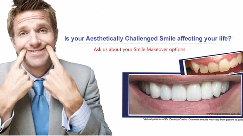 Affordable Tooth Decay Treatment | Best & Gentle Dental Fillings Melbourne CBD | BEST DENTIST MELBOURNE CBD Affordable Tooth Decay Treatment | Best & Gentle Dental Fillings Melbourne CBD | BEST DENTIST MELBOURNE CBD
