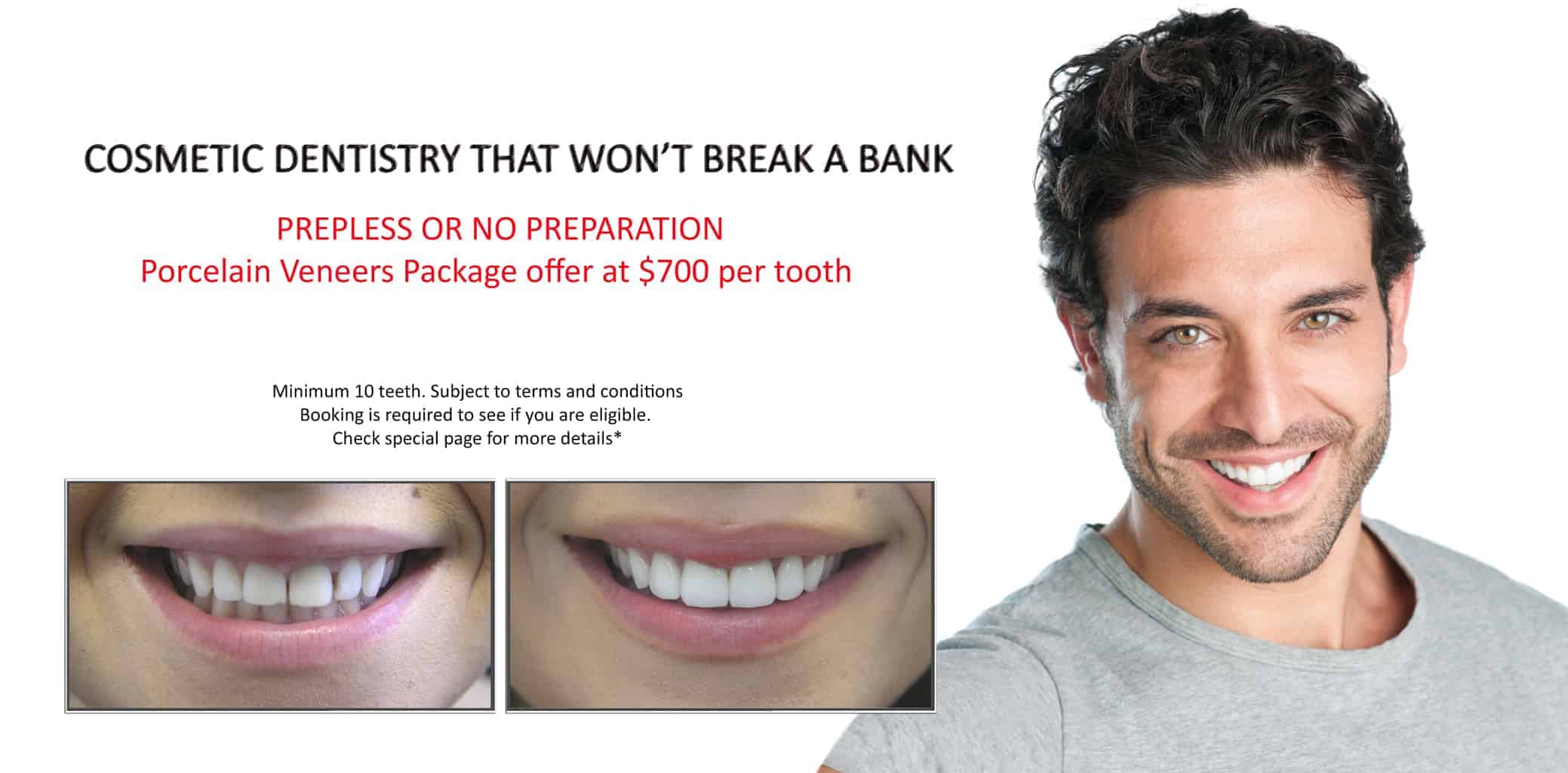 Affordable Tooth Decay Treatment | Best & Gentle Dental Fillings Melbourne CBD | BEST DENTIST MELBOURNE CBD Affordable Tooth Decay Treatment | Best & Gentle Dental Fillings Melbourne CBD | BEST DENTIST MELBOURNE CBD