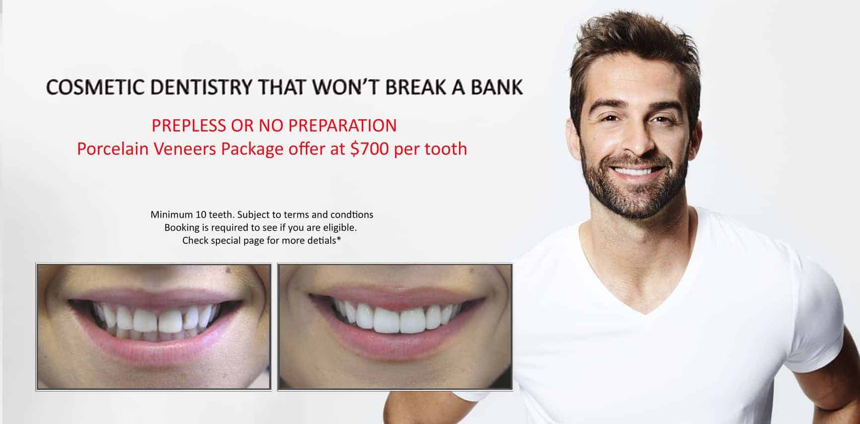 Beautiful Smiles with Lumineers Veneers Melbourne CBD | Dental Veneers Melbourne