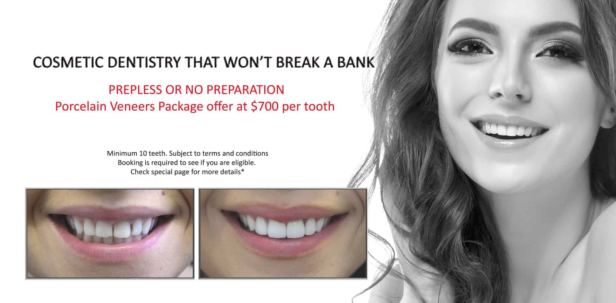 Affordable Tooth Decay Treatment | Best & Gentle Dental Fillings Melbourne CBD | BEST DENTIST MELBOURNE CBD Affordable Tooth Decay Treatment | Best & Gentle Dental Fillings Melbourne CBD | BEST DENTIST MELBOURNE CBD