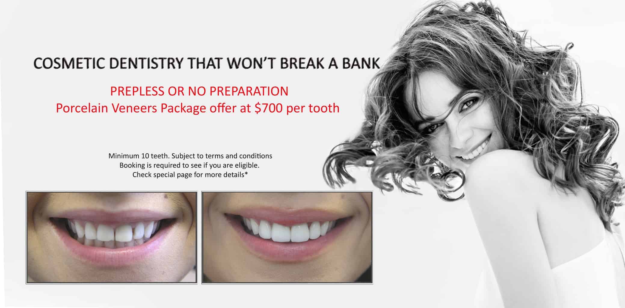 Beautiful Smiles with Lumineers Veneers Melbourne CBD | Dental Veneers Melbourne