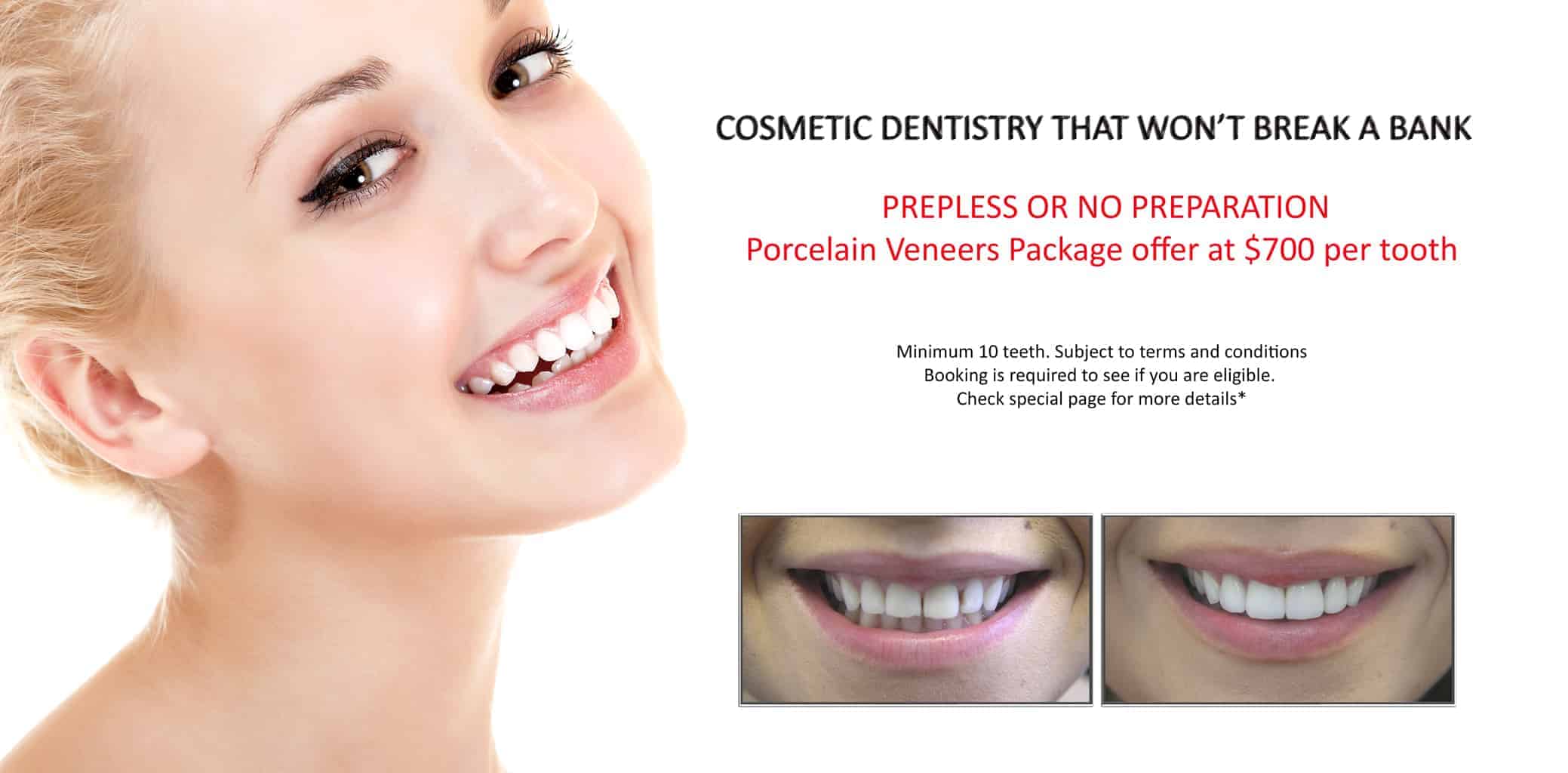 Affordable Tooth Decay Treatment | Best & Gentle Dental Fillings Melbourne CBD | BEST DENTIST MELBOURNE CBD Affordable Tooth Decay Treatment | Best & Gentle Dental Fillings Melbourne CBD | BEST DENTIST MELBOURNE CBD