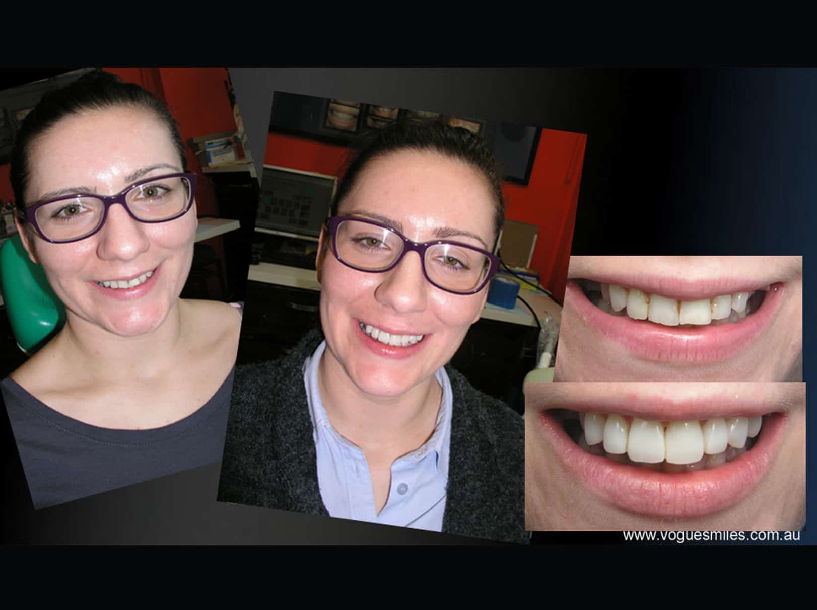 #1 Cosmetic Dentist in Melbourne- Australia Dr Zenaidy Castro VOGUE SMILES MELBOURNE