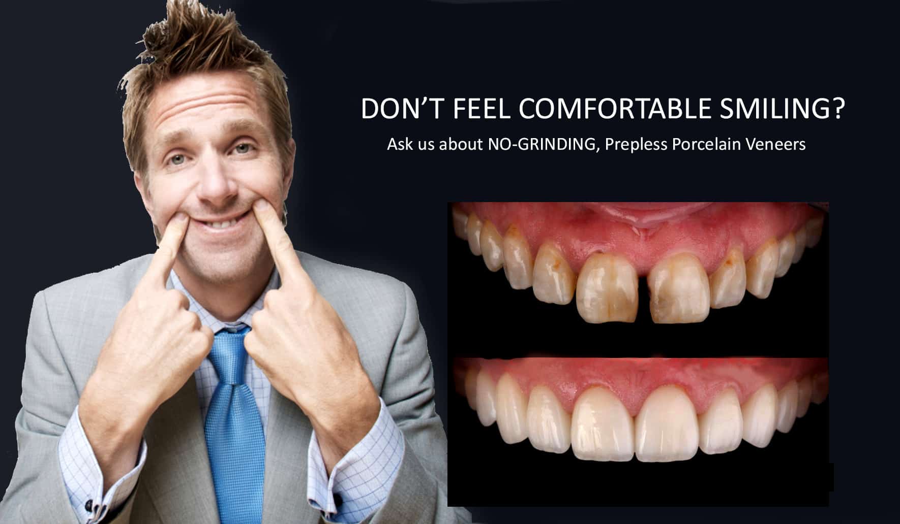 Fixing Short, Worn Down, Grinded down Teeth | Worn Teeth Treatment with Dental Veneers Melbourne CBD Cosmetic Dentistry