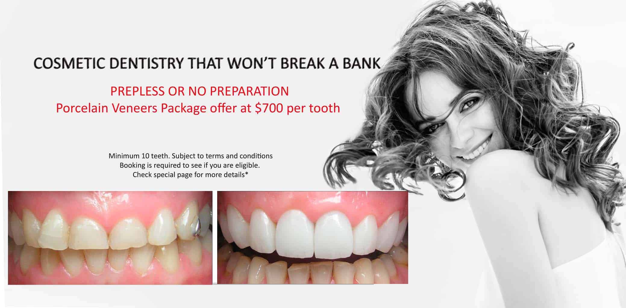 Porcelain Veneer Specials & Packages Melbourne CBD | Best Porcelain Veneer cosmetic dentist Melbourne