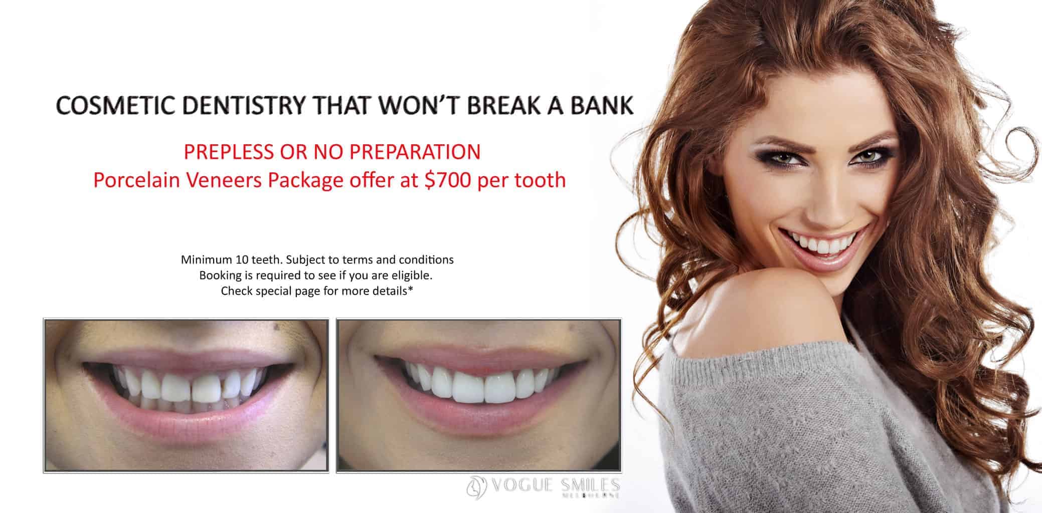 Teeth Whitening Cost and FAQs - How Much Does Teeth Whitening Cost In Melbourne?