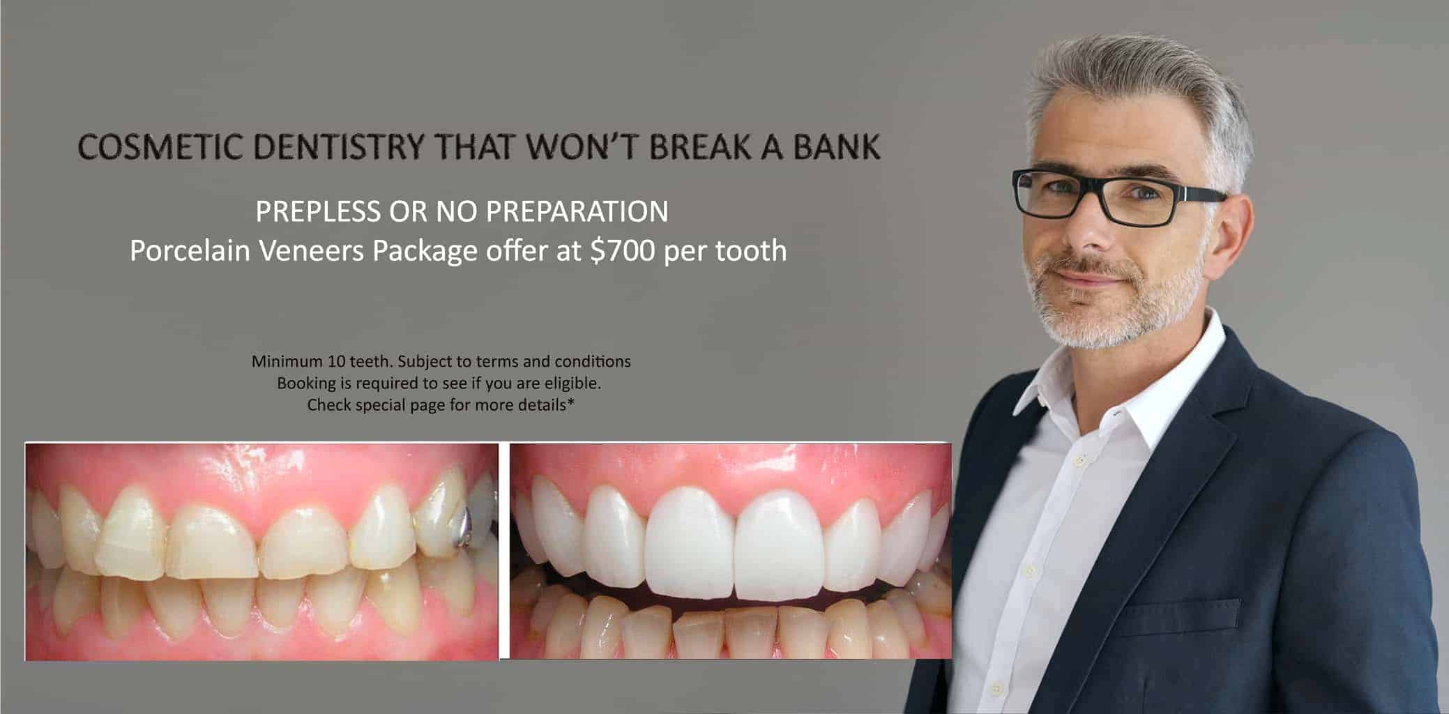 Tooth Wear Treatment Melbourne CBD