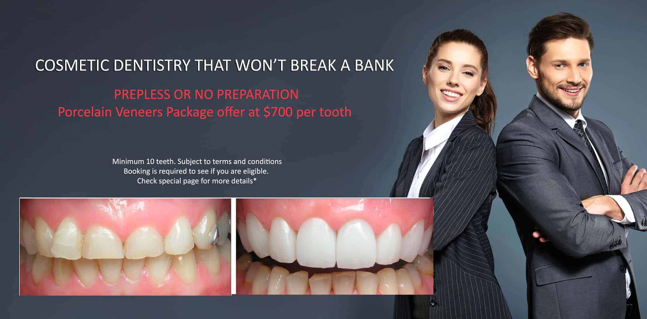 Permanent Teeth Whitening Treatment With Porcelain Veneers- MELBOURNE CBD COSMETIC DENTIST 