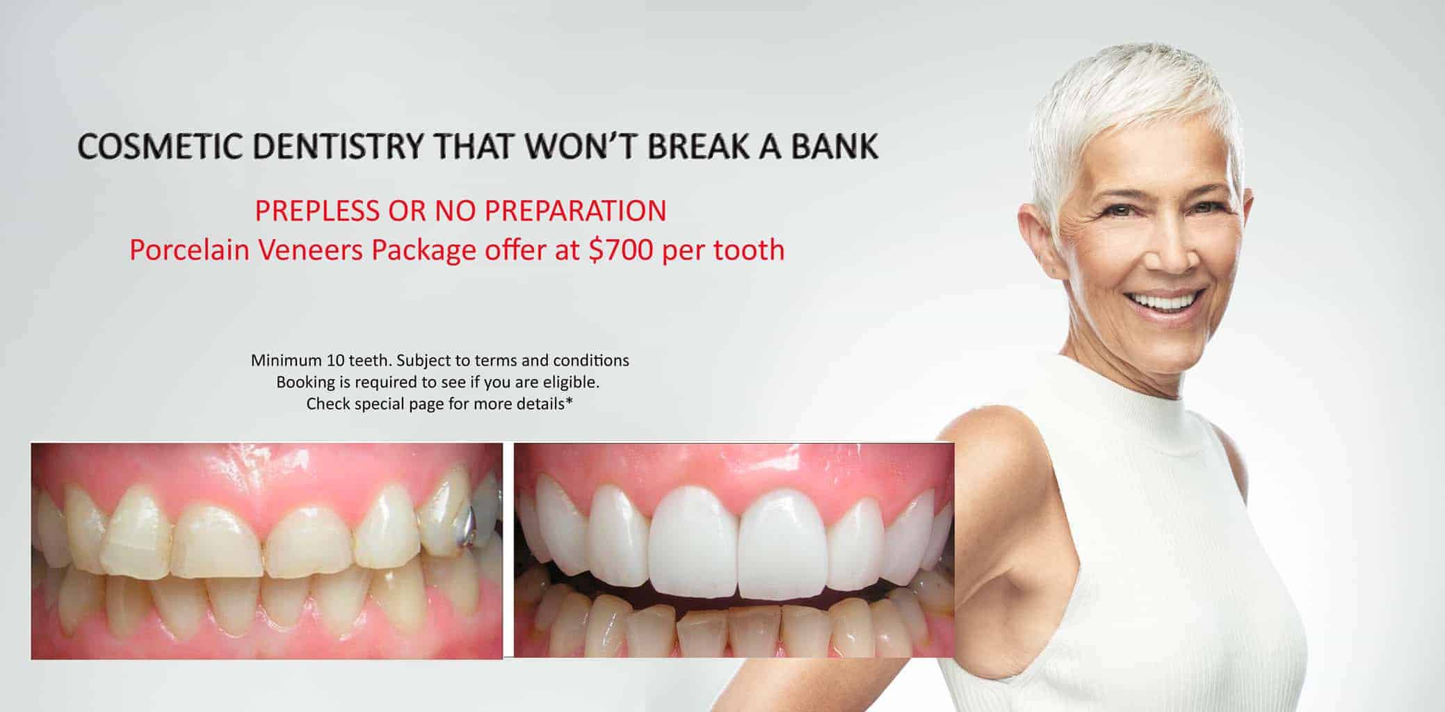 How Much Does a Smile Makeover with Porcelain Veneer Cost?