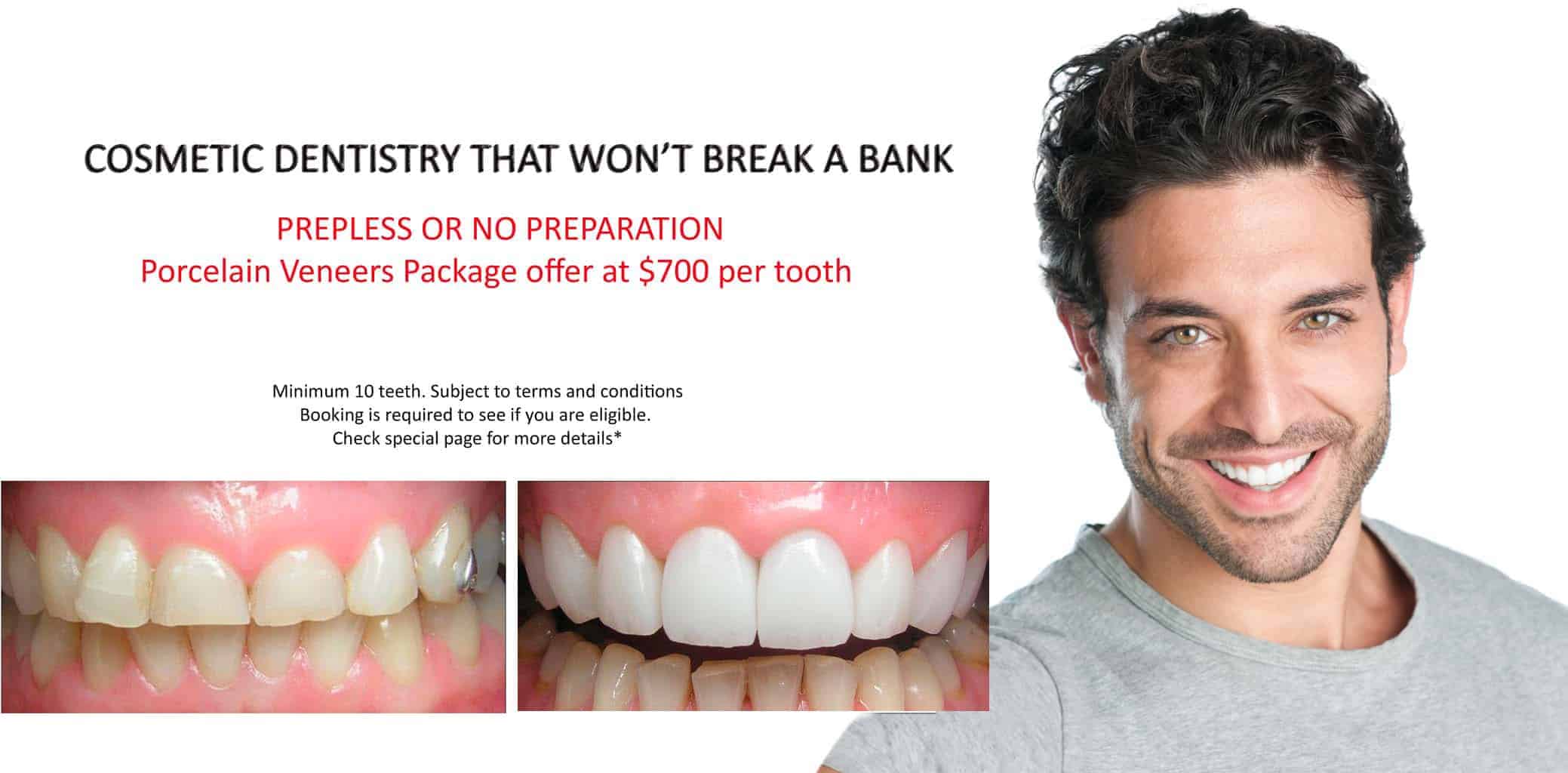 Porcelain Veneers Melbourne | Porcelain Veneer Specialist