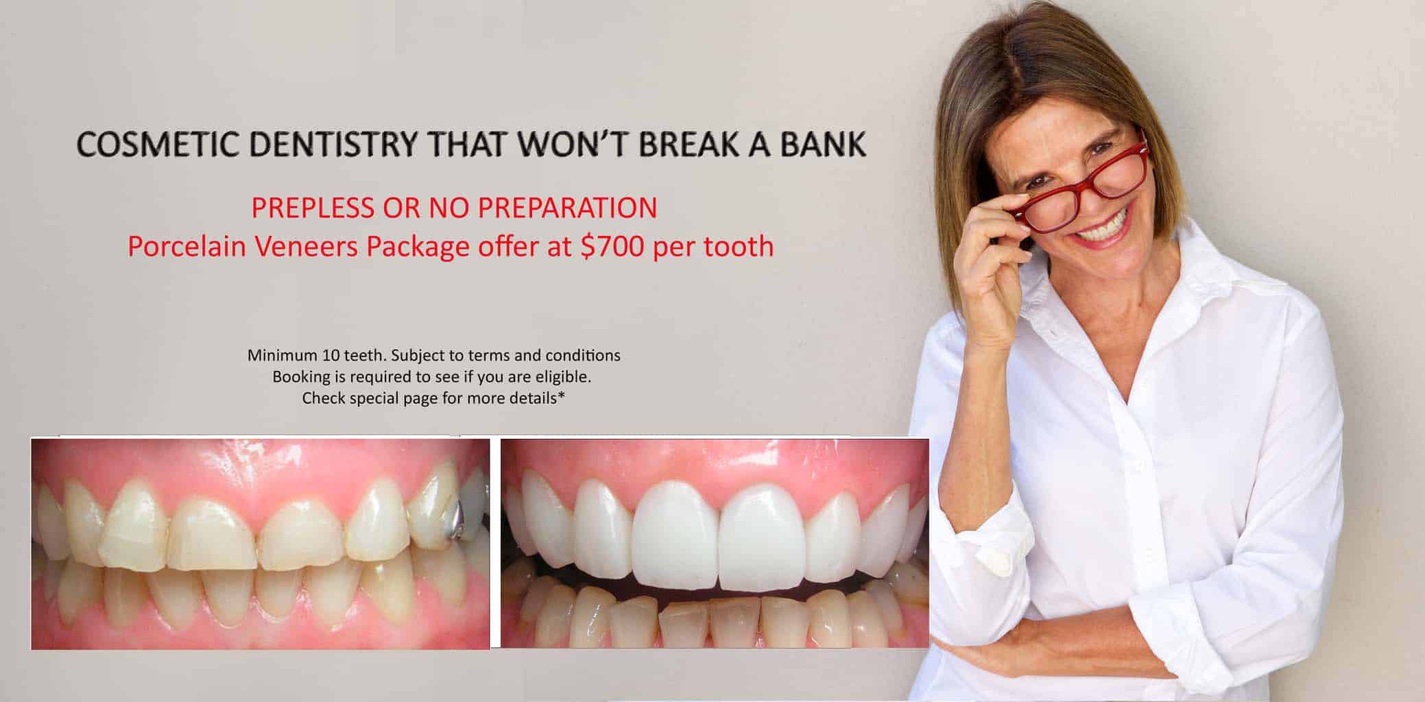 Beautiful Smiles with Lumineers Veneers Melbourne CBD | Dental Veneers Melbourne