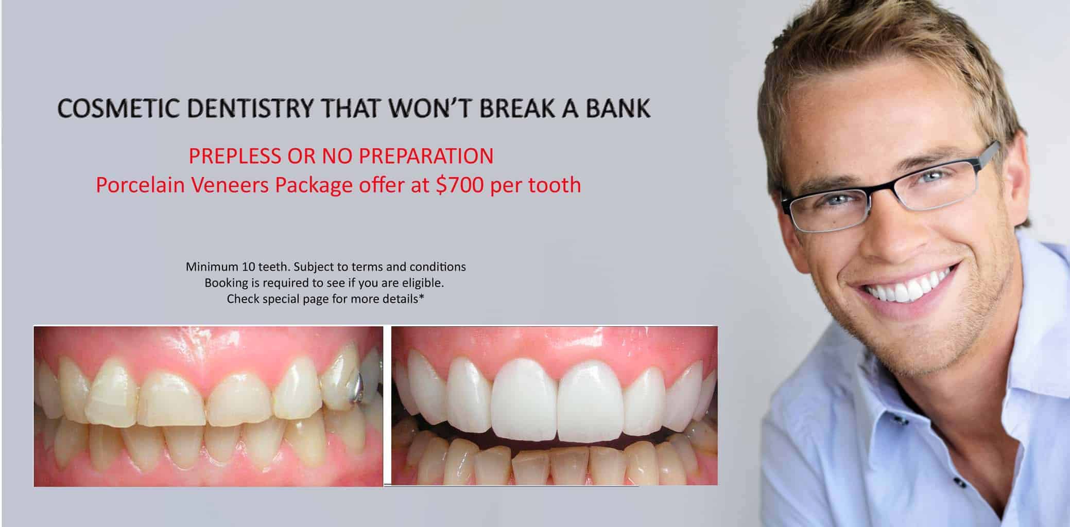 Cost of Cosmetic Dental Bonding or Composite Veneers -Cosmetic Dentist in Melbourne CBD
