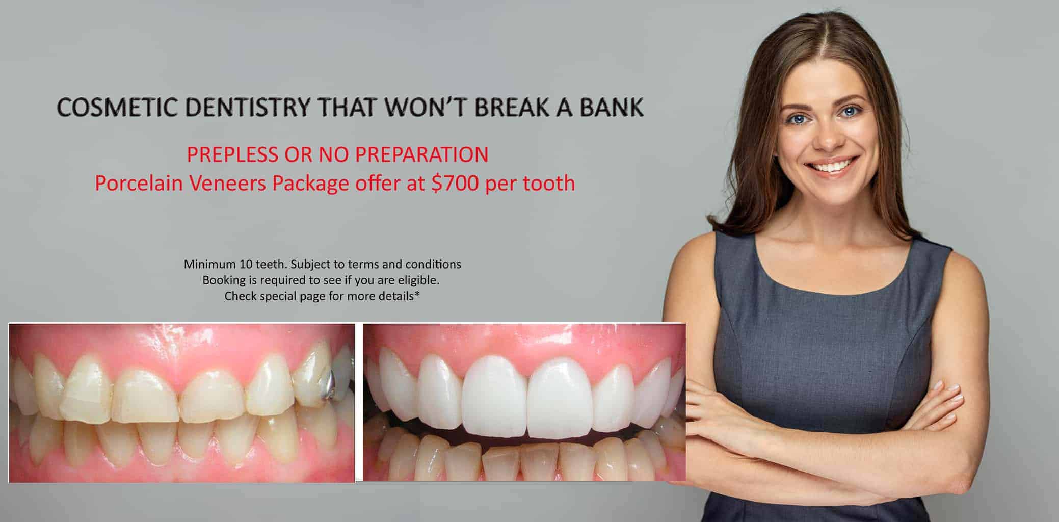 PORCELAIN VENEERS IN MELBOURNE | YOUR COMPLETE COMPLETE GUIDE TO PORCELAIN VENEERS | GET A FREE QUOTE