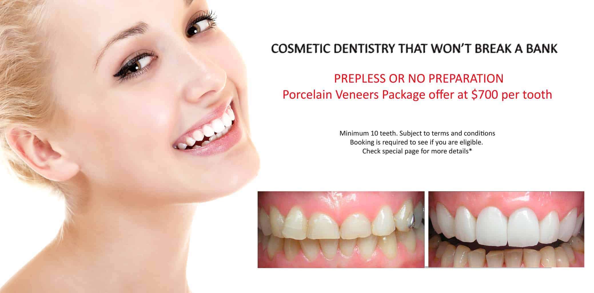 Beautiful Smiles with Lumineers Veneers Melbourne CBD | Dental Veneers Melbourne