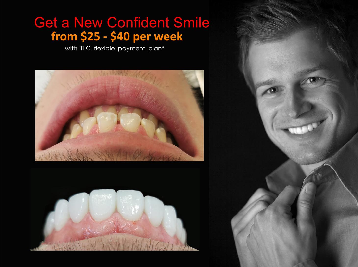 Smile Makeover Procedures Melbourne CBD Victoria Australia - Best Dentist Melbourne - Dr Zenaidy Castro - VOGUE SMILES MELBOURNE