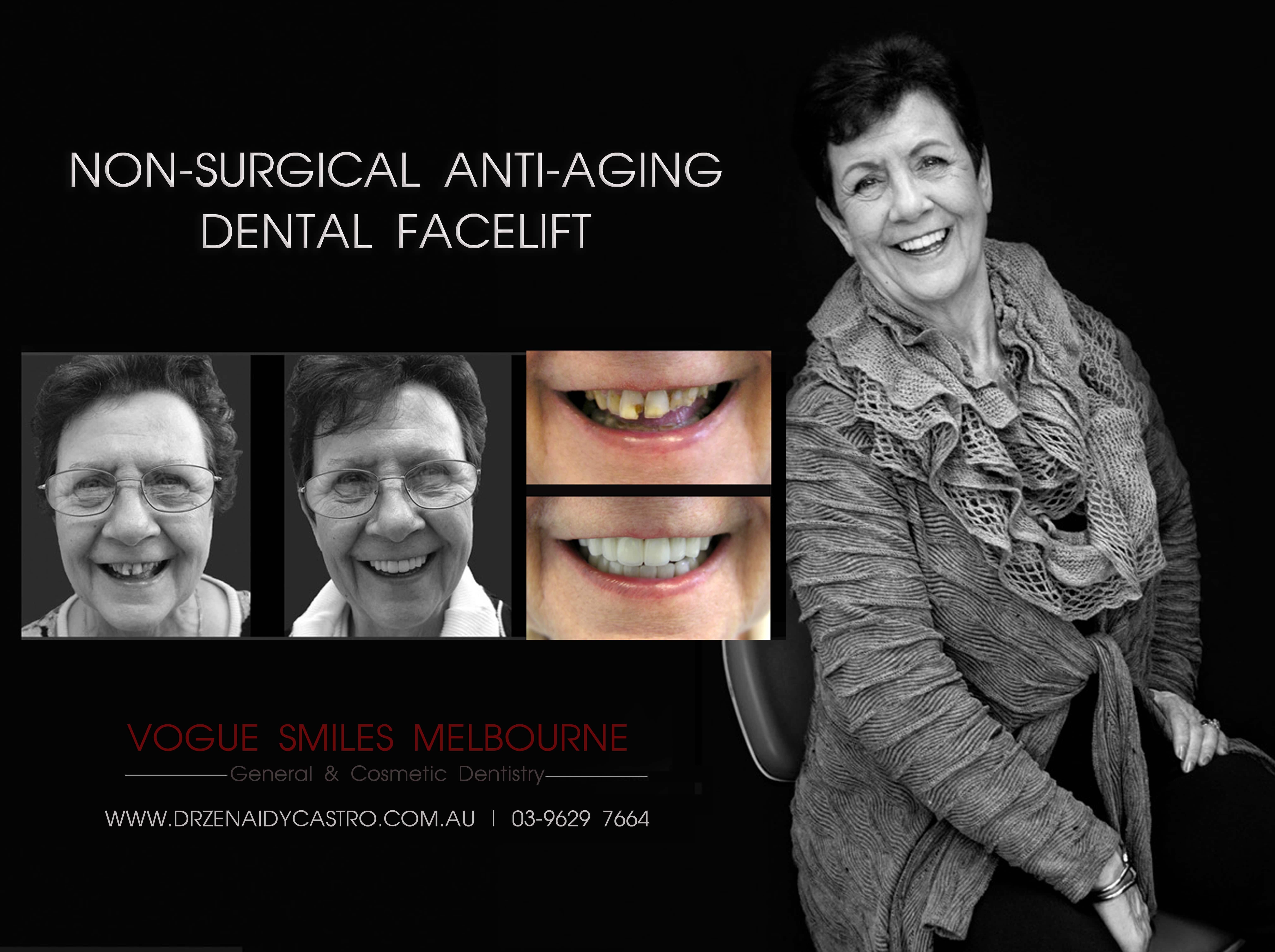 Non-surgical facelift procedure with Dental Veneers Melbourne CBD -Anti-aging expert Melbourne CBD, Non-Surgical & Minimally Invasive Facial and Smile Rejuvenation Melbourne