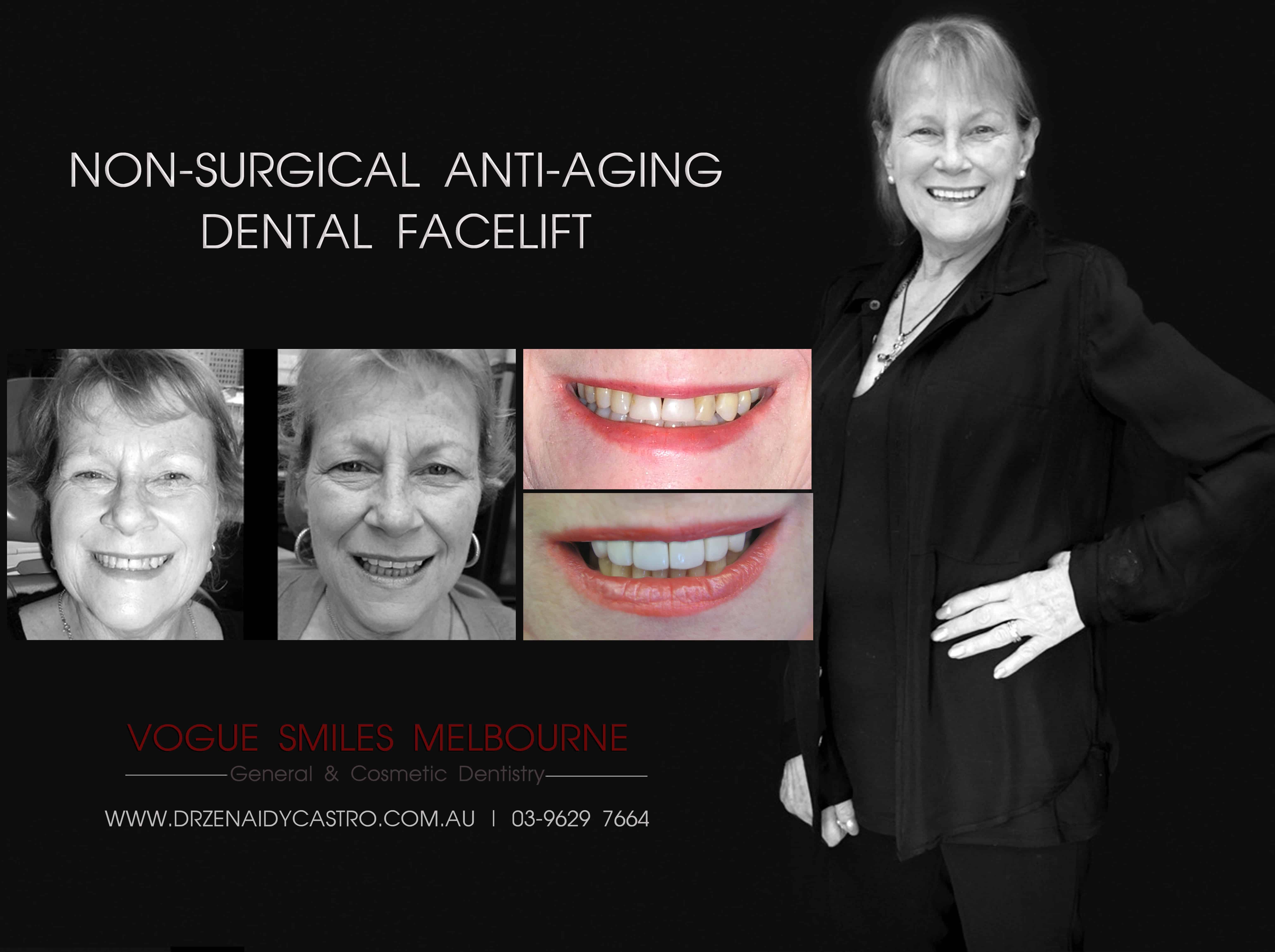 Smile Rejuvenation by Vogue Smiles Melbourne, rejuvenation clinic Melbourne, Non-surgical Facial Rejuvenation Melbourne, Anti Aging Treatment Melbourne