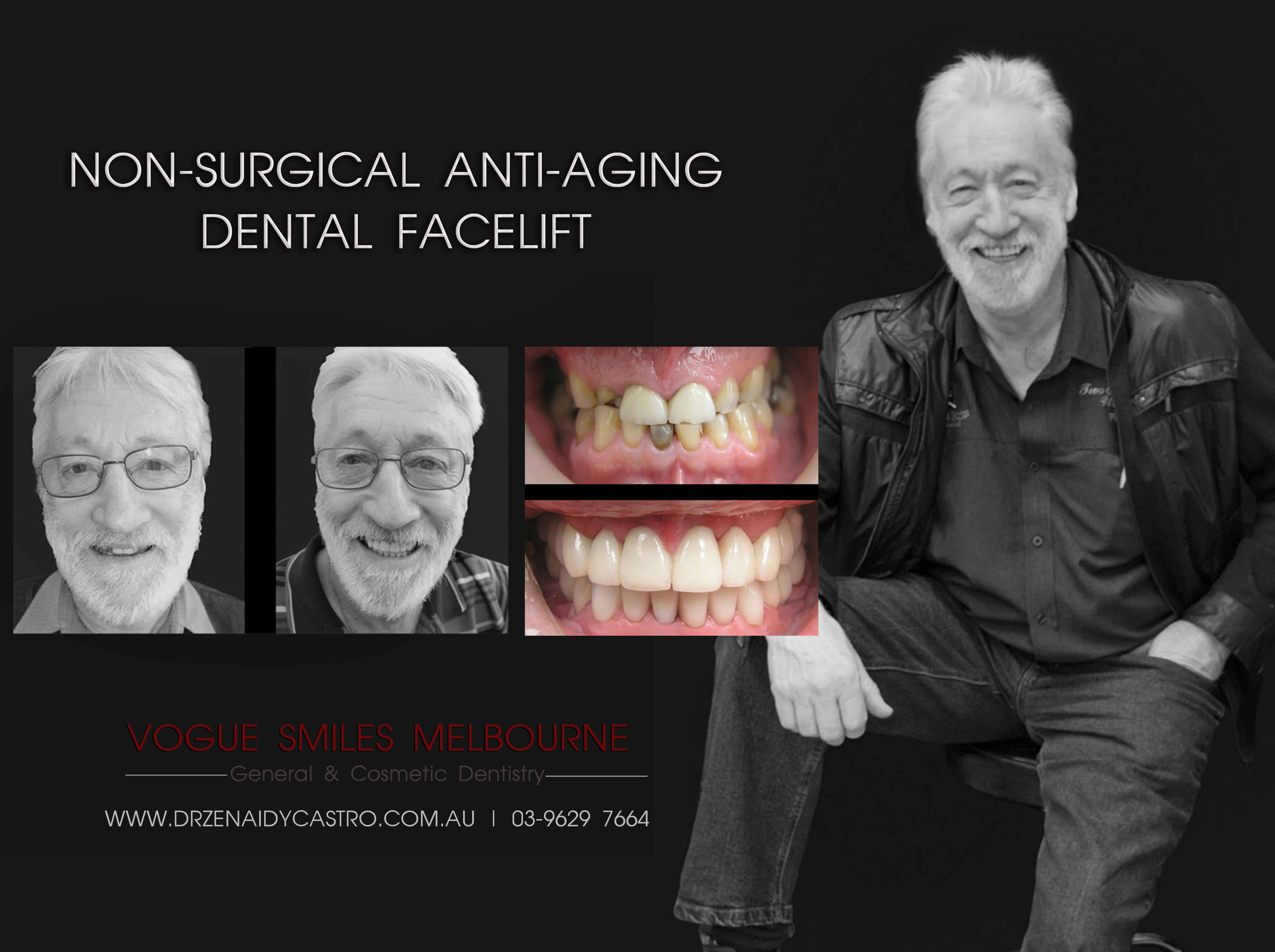 How to Look Younger with Smile Rejuvenation and Smile Makeovers treatment in Melbourne. Look and feel younger without surgical procedures with Cosmetic Dentistry in Melbourne CBD