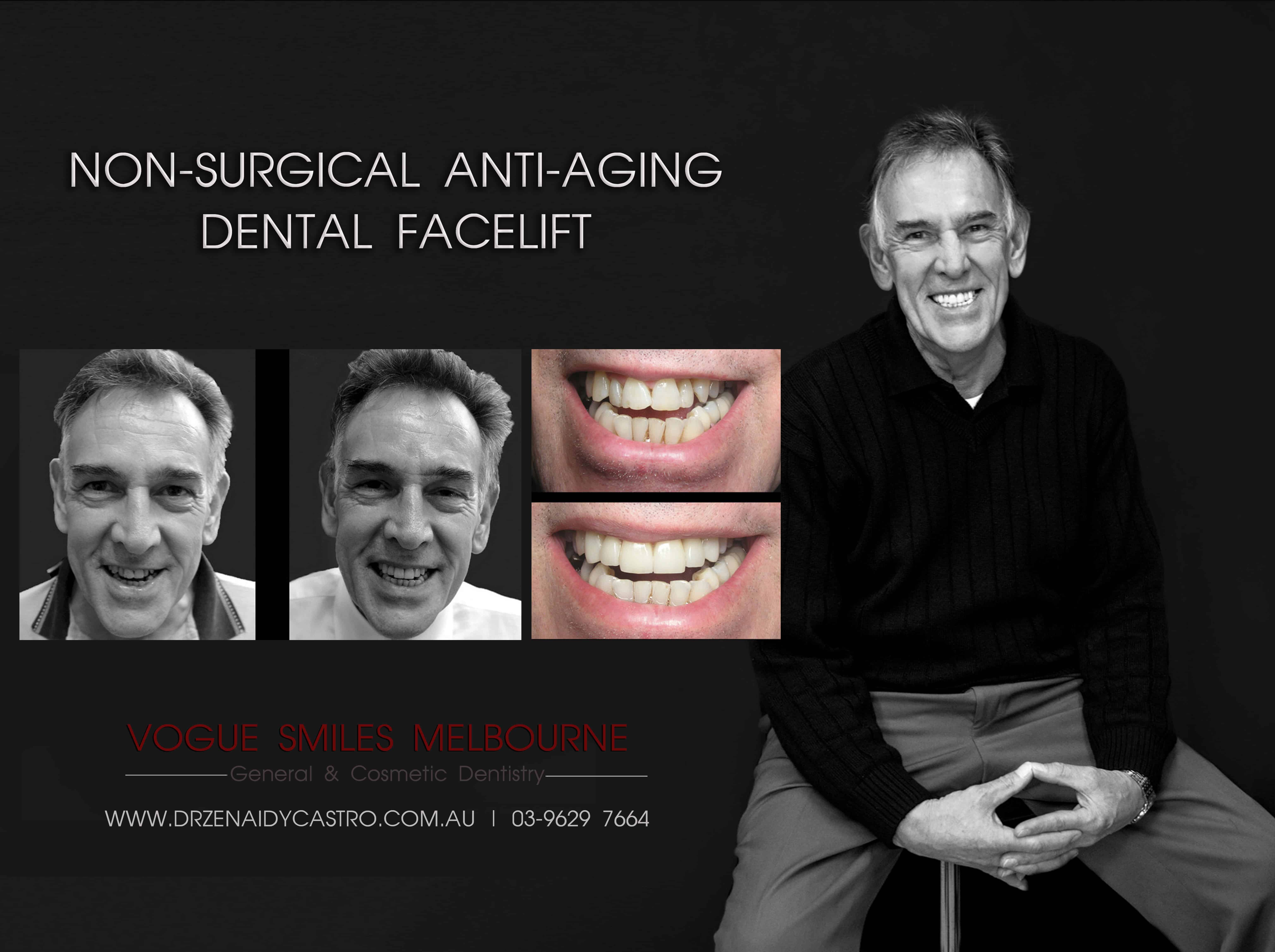 Anti-Aging Smile Rejuvenation Melbourne CBD- Cosmetic Dental Facelift Melbourne - look 10 years younger -Common Anti-Aging Treatments & Cosmetic Procedures -Non-surgical anti-ageing treatments