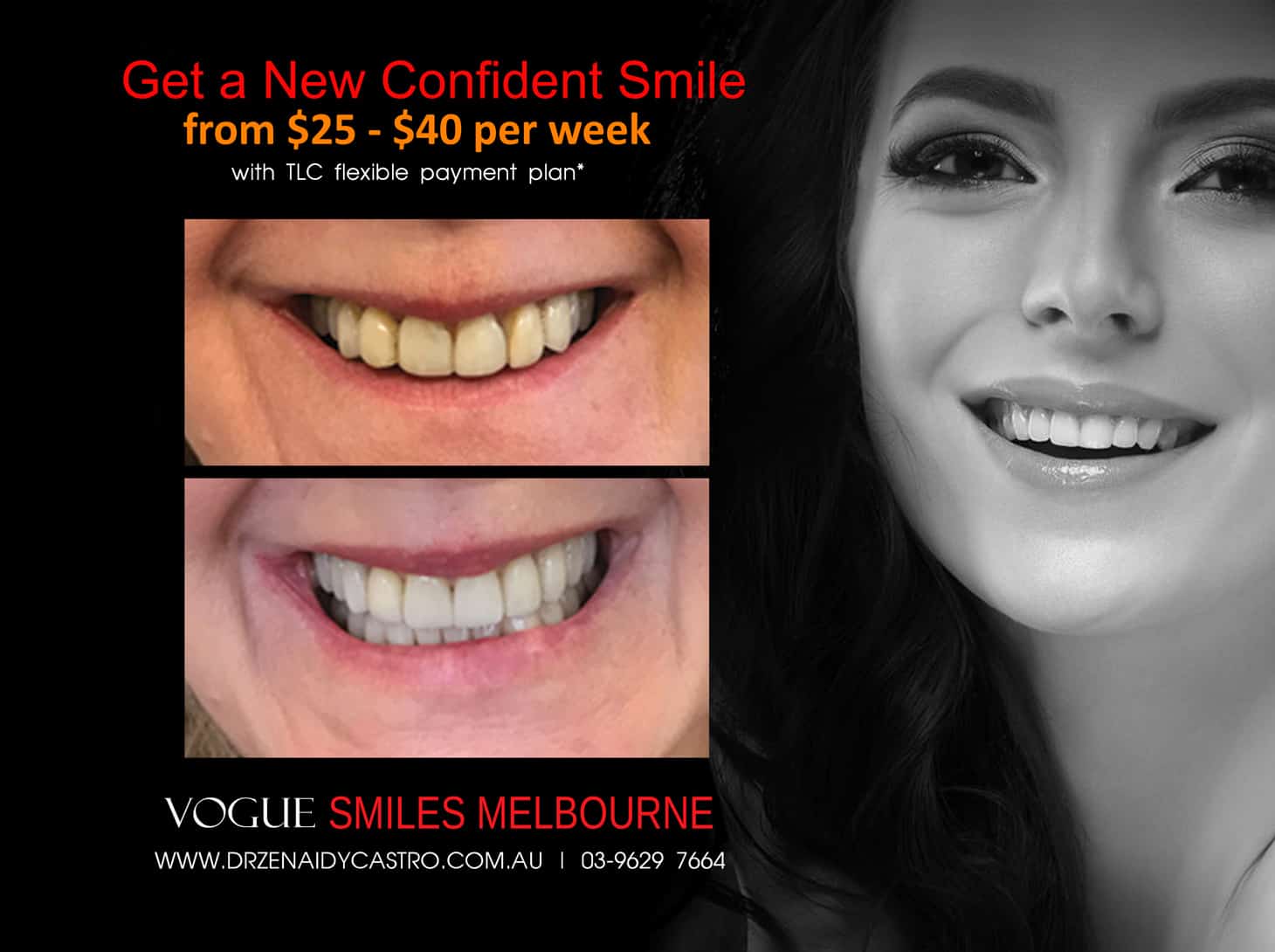 Smile Makeover Procedures Melbourne CBD Victoria Australia - Best Dentist Melbourne - Dr Zenaidy Castro - VOGUE SMILES MELBOURNE