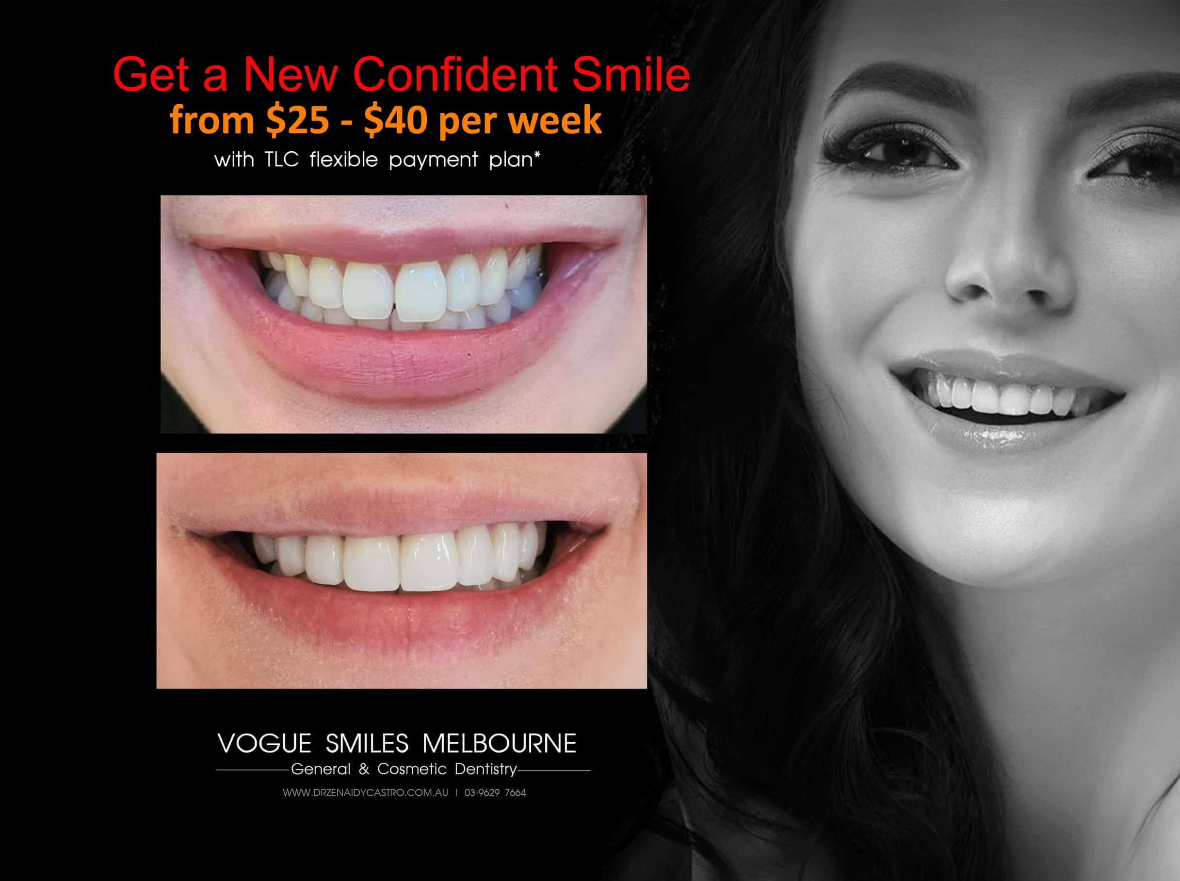 SMILE MAKEOVER PROCEDURES AND TREATMENT -Smile Makeover Melbourne, Teeth Transformation - Improve Smile Melbourne CBD Victoria Australia