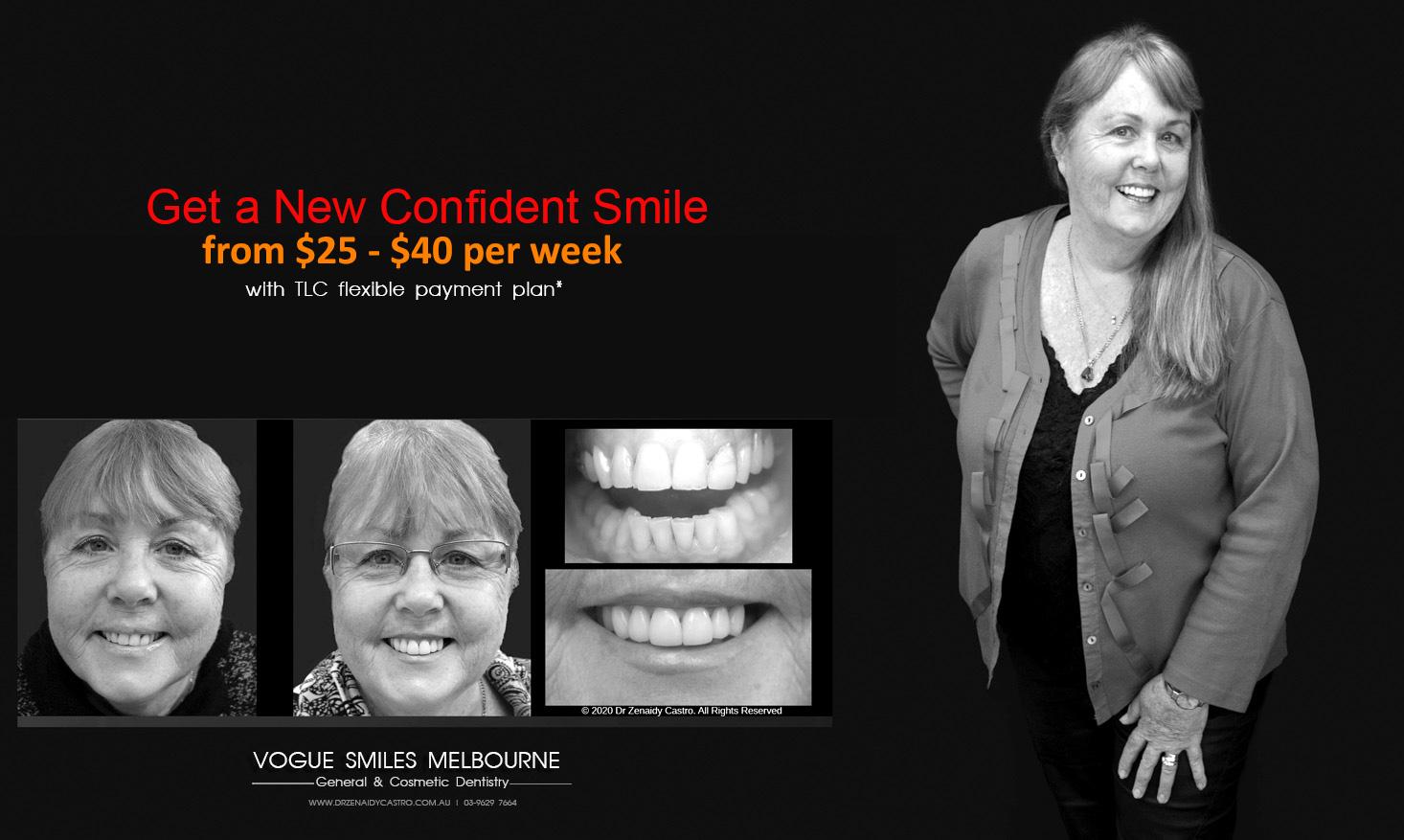 Dental Crowns Melbourne CBD, affordable dental crowns Melbourne, tooth capping promo offer