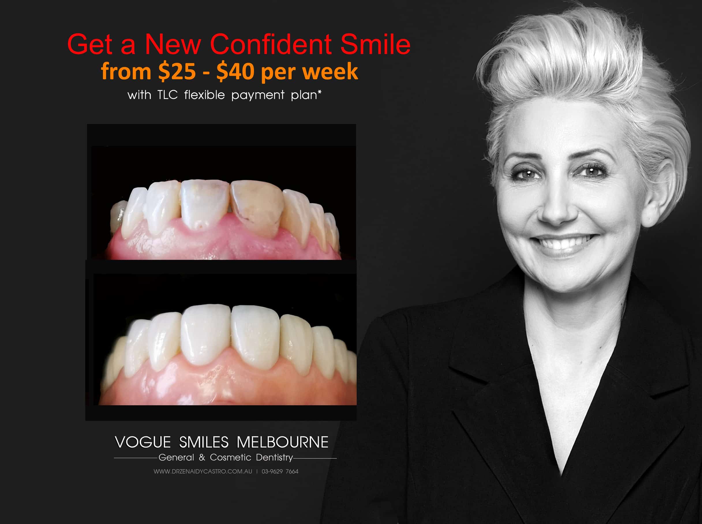 SMILE MAKEOVER PROCEDURES AND TREATMENT -Smile Makeover Melbourne, Teeth Transformation - Improve Smile Melbourne CBD Victoria Australia