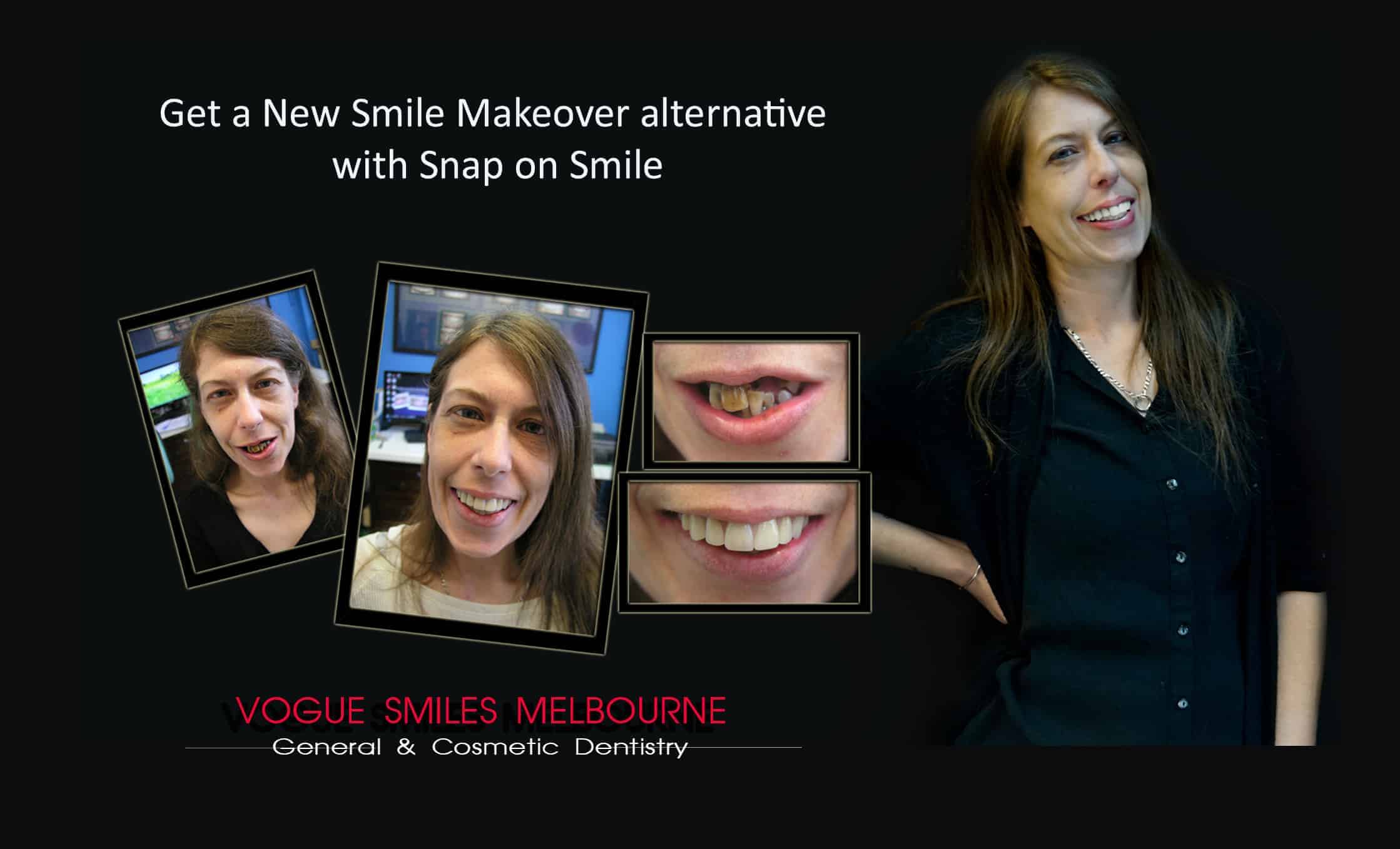 Smile Makeover Procedures Melbourne CBD Victoria Australia - Best Dentist Melbourne - Dr Zenaidy Castro - VOGUE SMILES MELBOURNE