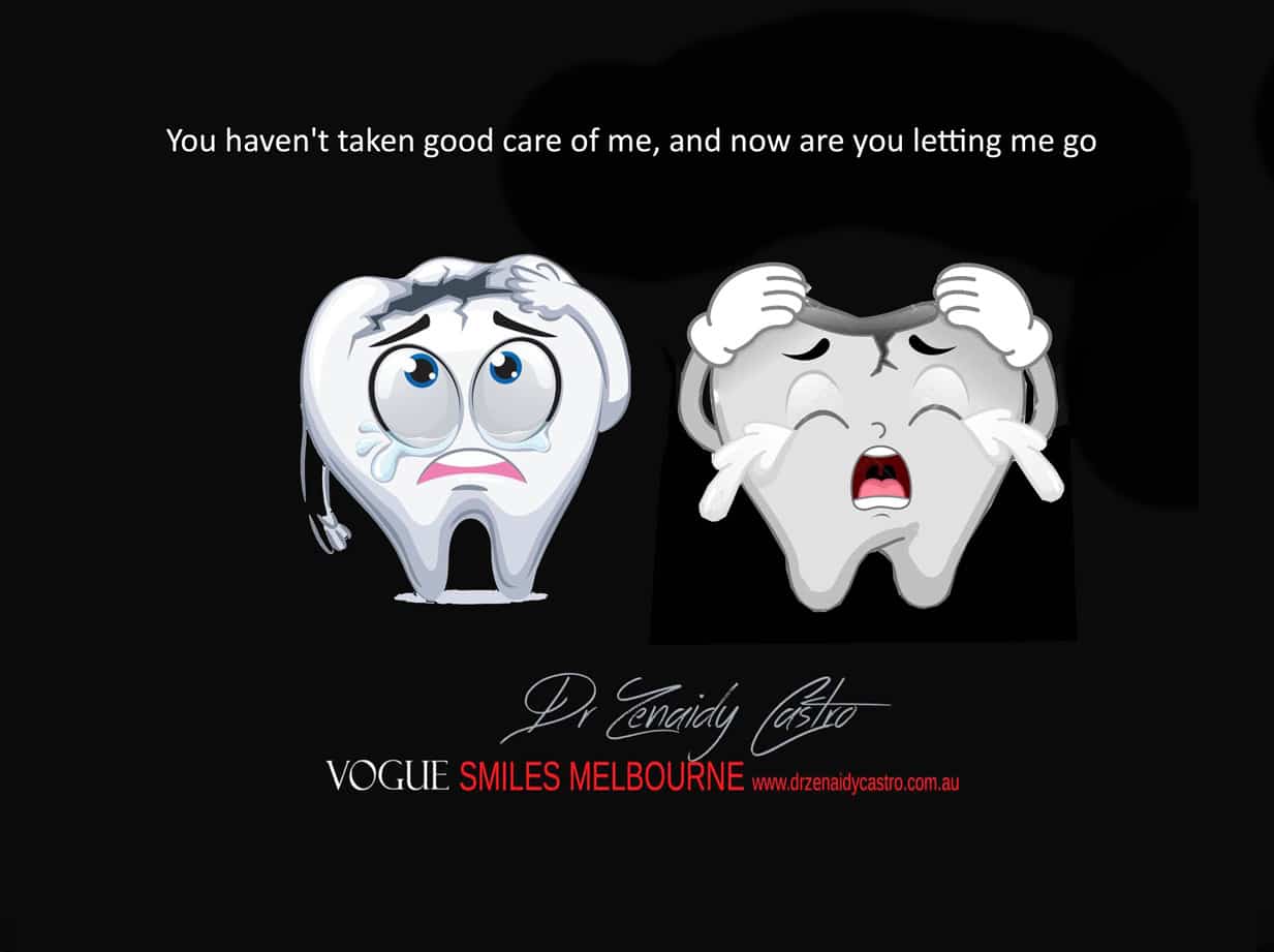 Tooth Removal and Extraction - Emergency Tooth Extraction, Dental Surgeon Melbourne CBD