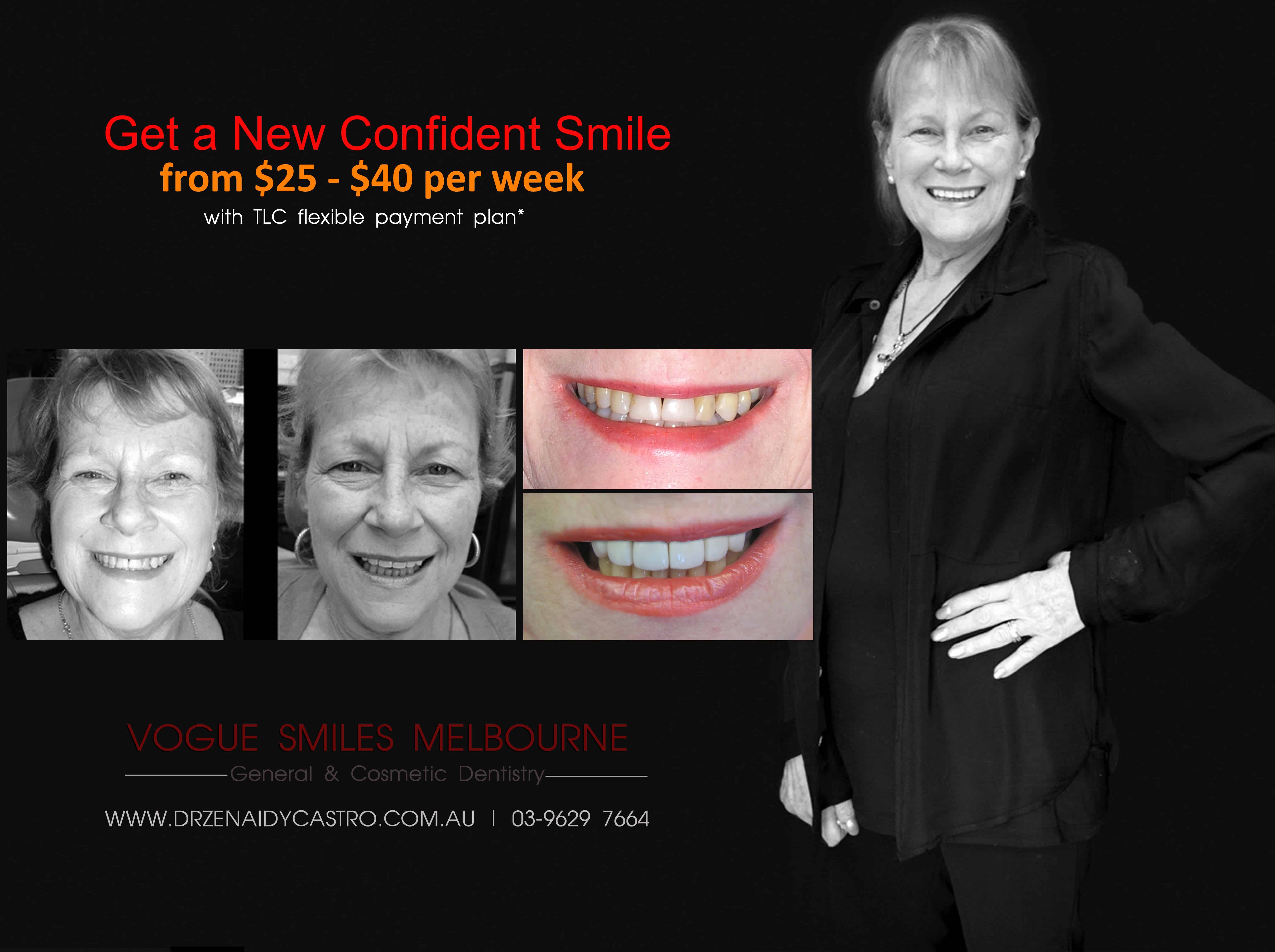 Non-surgical facelift procedure with Dental Veneers Melbourne CBD -Anti-aging expert Melbourne CBD, Non-Surgical & Minimally Invasive Facial and Smile Rejuvenation Melbourne