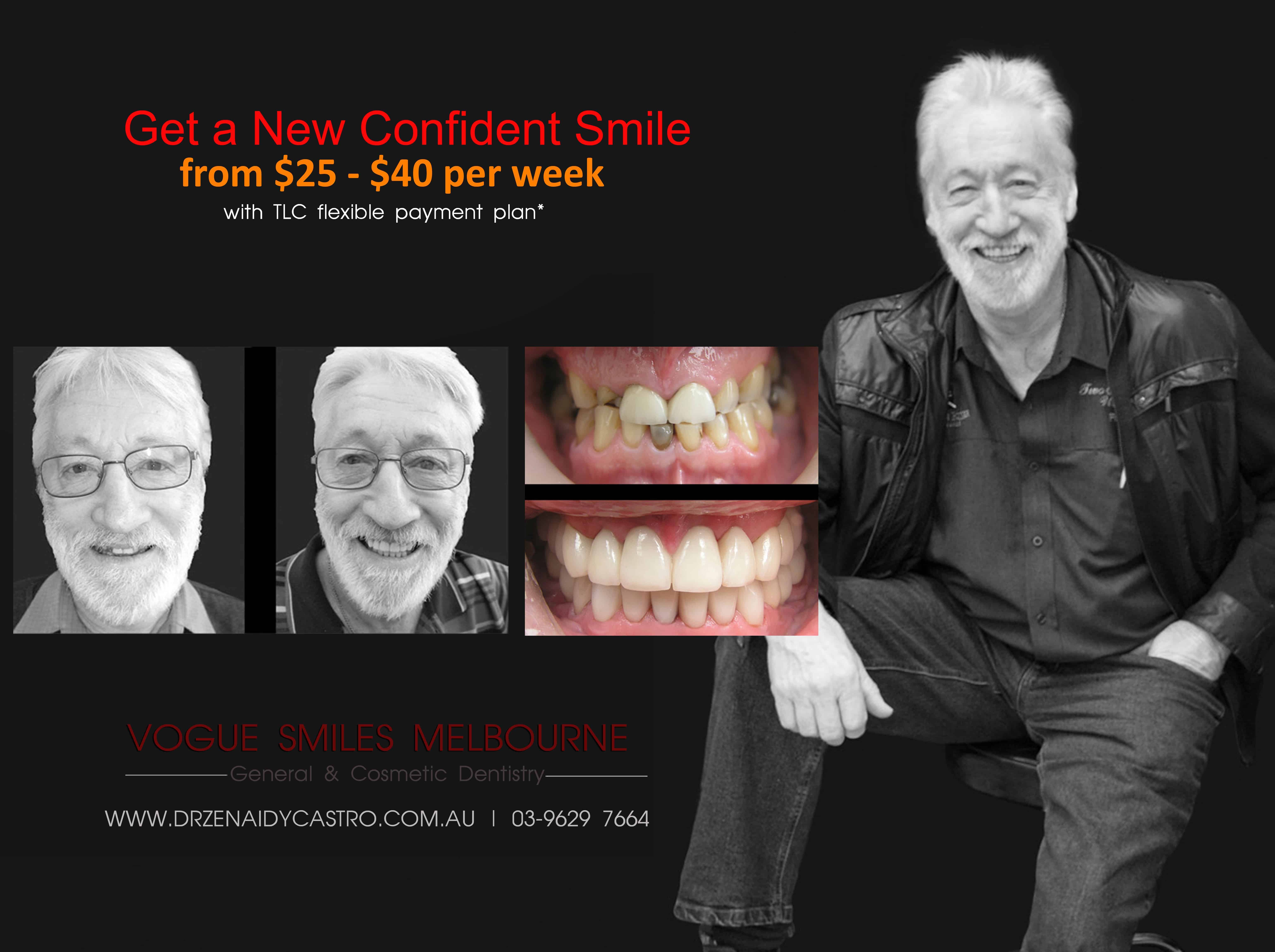 Dental Crowns Melbourne CBD, affordable dental crowns Melbourne, tooth capping promo offer